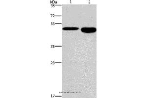 Western blot analysis of Mouse stomach and brain tissue, using DMRT3 Polyclonal Antibody at dilution of 1:550 (DMRT3 antibody)