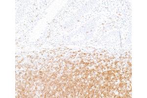 Immunohistochemistry (IHC) image for anti-CD247 Molecule (CD247) (C-Term) antibody (ABIN7454039)