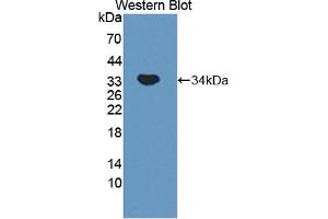 Detection of Recombinant MYO1G, Mouse using Polyclonal Antibody to Myosin IG (MYO1G) (MYO1G antibody  (AA 754-1018))