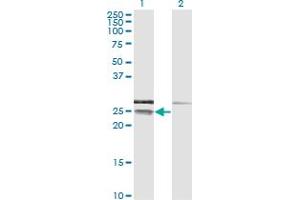 Western Blot analysis of CD99 expression in transfected 293T cell line by CD99 monoclonal antibody (M01), clone 3A10. (CD99 antibody  (AA 23-122))