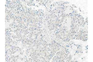 Immunohistochemistry (IHC) image for anti-TIP41-like protein (TIPRL) (C-Term) antibody (ABIN7453900)