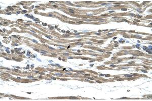 Rabbit Anti-COX15 Antibody  Paraffin Embedded Tissue: Human Muscle Cellular Data: Skeletal muscle cells Antibody Concentration: 4. (COX15 antibody  (N-Term))