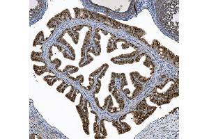 IHC analysis of FOXJ1 using anti-FOXJ1 antibody (ABIN7601015). (FOXJ1 antibody  (AA 27-405))