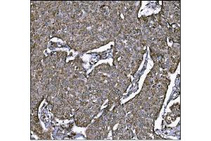 IHC analysis of LRP1B using anti-LRP1B antibody (ABIN7601521). (LRP1B antibody  (AA 3704-4547))