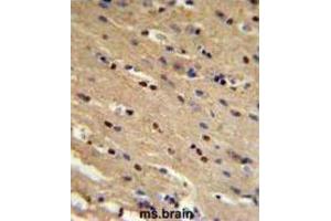 Immunohistochemistry (IHC) image for anti-Tumor Protein P73 (TP73) antibody (ABIN3003949) (Tumor Protein p73 antibody)