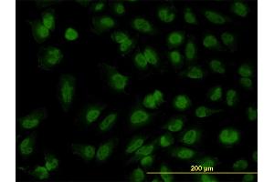 Immunofluorescence of monoclonal antibody to FOXR2 on HeLa cell. (FOXR2 antibody  (AA 1-311))
