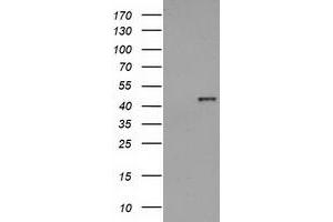 HEK293T cells were transfected with the pCMV6-ENTRY control (Left lane) or pCMV6-ENTRY HAO1 (Right lane) cDNA for 48 hrs and lysed. (HAO1 antibody)