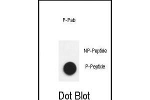 Dot blot analysis of anti-Phospho-Nephrin  antibody Phospho-specific Pab (ABIN650883 and ABIN2839826) on nitrocellulose membrane. (Nephrin antibody  (pTyr1193))