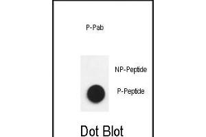 Dot blot analysis of anti-Phospho-Nephrin  antibody Phospho-specific Pab (ABIN650883 and ABIN2839826) on nitrocellulose membrane. (Nephrin antibody  (pTyr1193))