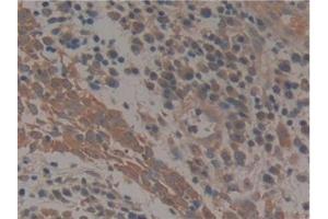 Immunohistochemistry (IHC) image for anti-Paxillin (PXN) (AA 201-461) antibody (ABIN7434188)