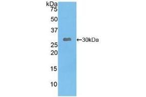 Detection of Recombinant LEPR, Human using Polyclonal Antibody to Leptin Receptor (LEPR) (Leptin Receptor antibody  (AA 310-539))