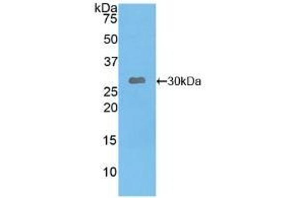 Leptin Receptor antibody  (AA 310-539)