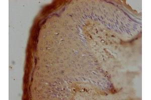 IHC image of ABIN7162249 diluted at 1:100 and staining in paraffin-embedded human skin tissue performed on a Leica BondTM system. (OPTC antibody  (AA 20-332))