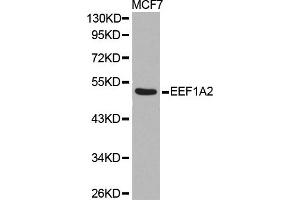 Western blot analysis of extracts of MCF7 cell line, using EEF1A2 antibody. (EEF1A2 antibody)