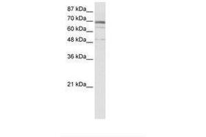 Image no. 1 for anti-Zinc Finger Protein 614 (ZNF614) (AA 56-105) antibody (ABIN6736025)
