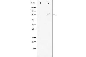 Western blot analysis of STAT2 phosphorylation expression in IFN treated HeLa whole cell lysates,The lane on the left is treated with the antigen-specific peptide. (STAT2 antibody  (pTyr690))