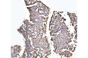 IHC analysis of MLX-interacting protein/MLXIP using anti-MLX-interacting protein/MLXIP antibody (ABIN7602593). (MLXIP antibody  (AA 88-348))