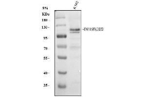 Western blot analysis of CD30/TNFRSF8 using anti-CD30/TNFRSF8 antibody (ABIN7603165).