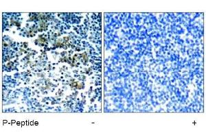 Image no. 1 for anti-Breakpoint Cluster Region (BCR) (pTyr177) antibody (ABIN196939) (BCR antibody  (pTyr177))
