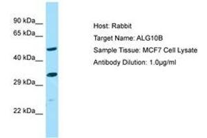 Image no. 1 for anti-Asparagine-Linked Glycosylation 10, alpha-1,2-Glucosyltransferase Homolog B (ALG10B) (AA 179-228) antibody (ABIN6750149) (ALG10B antibody  (AA 179-228))