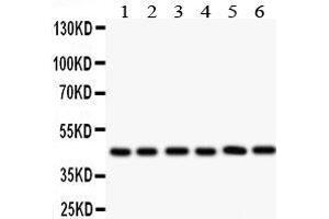 Anti- IL2RA antibody, Western blotting All lanes: Anti IL2RA  at 0.