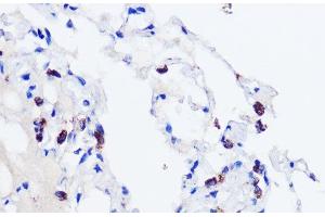 Immunohistochemistry of paraffin-embedded Human lung using SFTPC Polyclonal Antibody at dilution of 1:200 (40x lens). (Surfactant Protein C antibody)
