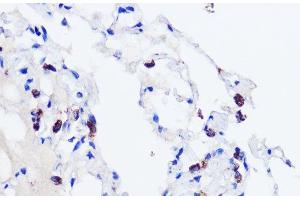 Immunohistochemistry of paraffin-embedded Human lung using SFTPC Polyclonal Antibody at dilution of 1:200 (40x lens).