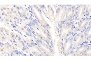 Immunohistochemistry (IHC) image for anti-Eukaryotic Translation Initiation Factor 2-alpha Kinase 3 (EIF2AK3) (AA 973-1114) antibody (ABIN7441241)