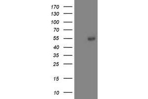 HEK293T cells were transfected with the pCMV6-ENTRY control (Left lane) or pCMV6-ENTRY ACY1 (Right lane) cDNA for 48 hrs and lysed. (Aminoacylase 1 antibody)