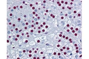 Anti-SF1 antibody IHC of human adrenal. (Splicing Factor 1 antibody  (AA 1-111))