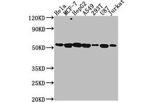Western Blot Positive WB detected in: Hela whole cell lysate, MCF-7 whole cell lysate, HepG2 whole cell lysate, A549 whole cell lysate, 293T whole cell lysate, U87 whole cell lysate, Jurkat whole cell lysate All lanes: PRAMEF6 antibody at 1:2000 Secondary Goat polyclonal to rabbit IgG at 1/50000 dilution Predicted band size: 55 kDa Observed band size: 55 kDa (PRAMEF6 antibody  (AA 209-476))
