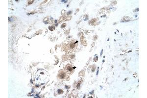 KIAA0494 antibody was used for immunohistochemistry at a concentration of 4-8 ug/ml to stain Decidual cells (arrows) in Human Placenta. (KIAA0494 antibody  (N-Term))