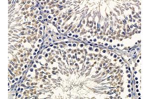 ABIN6262812 and ABIN6278290 at 1/100 staining rat testis tissue by IHC-P. (KIFAP3 antibody  (N-Term))