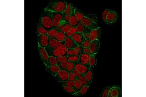 Immunofluorescent staining of paraformaldehyde-fixed MCF-7 cells with Catenin, gamma Mouse Monoclonal Antibody (CTNG/1664) followed by goat anti-Mouse IgG-CF488 (Green). (JUP antibody)