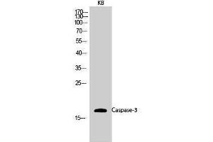 Western Blotting (WB) image for anti-Caspase 3 (CASP3) (Ser1981) antibody (ABIN3183667) (Caspase 3 antibody  (Ser1981))