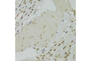 Immunohistochemistry (Paraffin-embedded Sections) (IHC (p)) image for anti-X-Ray Repair Complementing Defective Repair in Chinese Hamster Cells 6 (XRCC6) (AA 500-600) antibody (ABIN1513143)