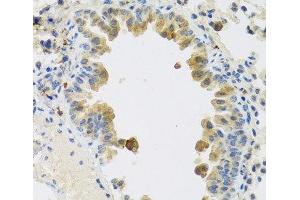 Immunohistochemistry of paraffin-embedded Mouse lung using RSPO1 Polyclonal Antibody at dilution of 1:100 (40x lens). (RSPO1 antibody)