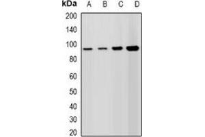 Western blot analysis of Lsh expression in A549 (A), HepG2 (B), mouse spleen (C), rat testis (D) whole cell lysates. (SLC11A1 antibody)