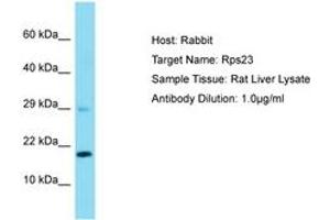 Image no. 1 for anti-Ribosomal Protein S23 (RPS23) (AA 15-64) antibody (ABIN6750515) (RPS23 antibody  (AA 15-64))