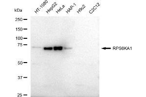 Western blotting analysis using RPS6KA1 antibody (ABIN7800229).