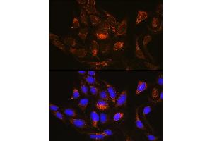 Immunofluorescence analysis of U-2 OS cells using R Rabbit pAb (ABIN6128425, ABIN6146547, ABIN6146548 and ABIN6214868) at dilution of 1:100 (40x lens). (RAB13 antibody  (AA 1-203))