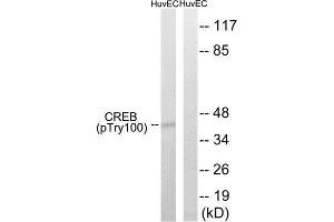 Western Blotting (WB) image for anti-cAMP Responsive Element Binding Protein 1 (CREB1) (pThr100) antibody (ABIN1847546) (CREB1 antibody  (pThr100))