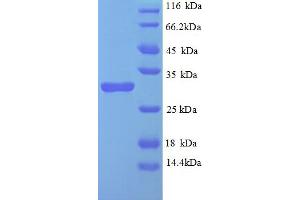 SDS-PAGE (SDS) image for Egl-9 Family Hypoxia Inducible Factor 3 (EGLN3) (AA 2-239) protein (His tag) (ABIN5712938) (EGLN3 Protein (AA 2-239) (His tag))
