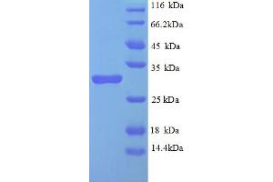 SDS-PAGE (SDS) image for Egl-9 Family Hypoxia Inducible Factor 3 (EGLN3) (AA 2-239) protein (His tag) (ABIN4976805)