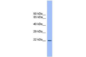 WB Suggested Anti-CD3E Antibody Titration: 0.