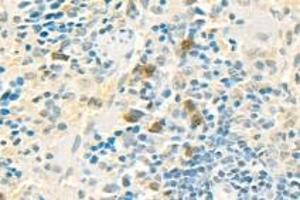 Immunohistochemistry analysis of paraffin-embedded mouse spleen using PPP2R2A (ABIN7075274) at dilution of 1: 2000 (PPP2R2A antibody)