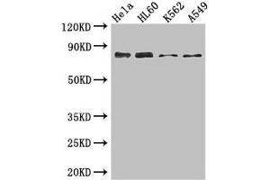 Western Blot Positive WB detected in: Hela whole cell lysate, HL60 whole cell lysate, K562 whole cell lysate, A549 whole cell lysate All lanes: SSRP1 antibody at 3. (SSRP1 antibody  (AA 1-242))