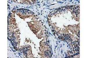 Immunohistochemical staining of paraffin-embedded Kidney tissue using anti-ELAVL1mouse monoclonal antibody.