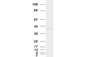 Western Blotting (WB) image for Sarcoglycan, beta (43kDa Dystrophin-Associated Glycoprotein) (SGCB) protein (Myc-DYKDDDDK Tag) (ABIN2731920)
