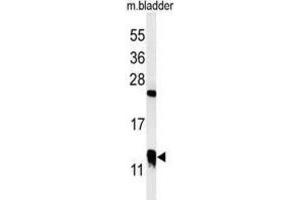 Western Blotting (WB) image for anti-Cysteine-Rich Protein 1 (Intestinal) (CRIP1) antibody (ABIN3002116) (CRIP1 antibody)